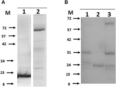 Towards Reverse Vaccinology for Bovine TB: High Throughput Expression of Full Length Recombinant Mycobacterium bovis Proteins